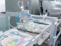 ماكينة تعبئة أكياس جاهزة ذات فوهة واحدة